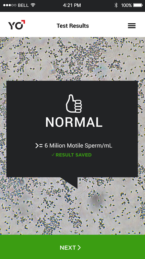 52_19_result_normal